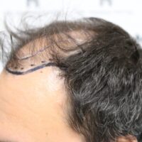 Chris V Before