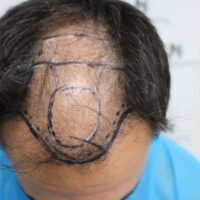 Chris V Before