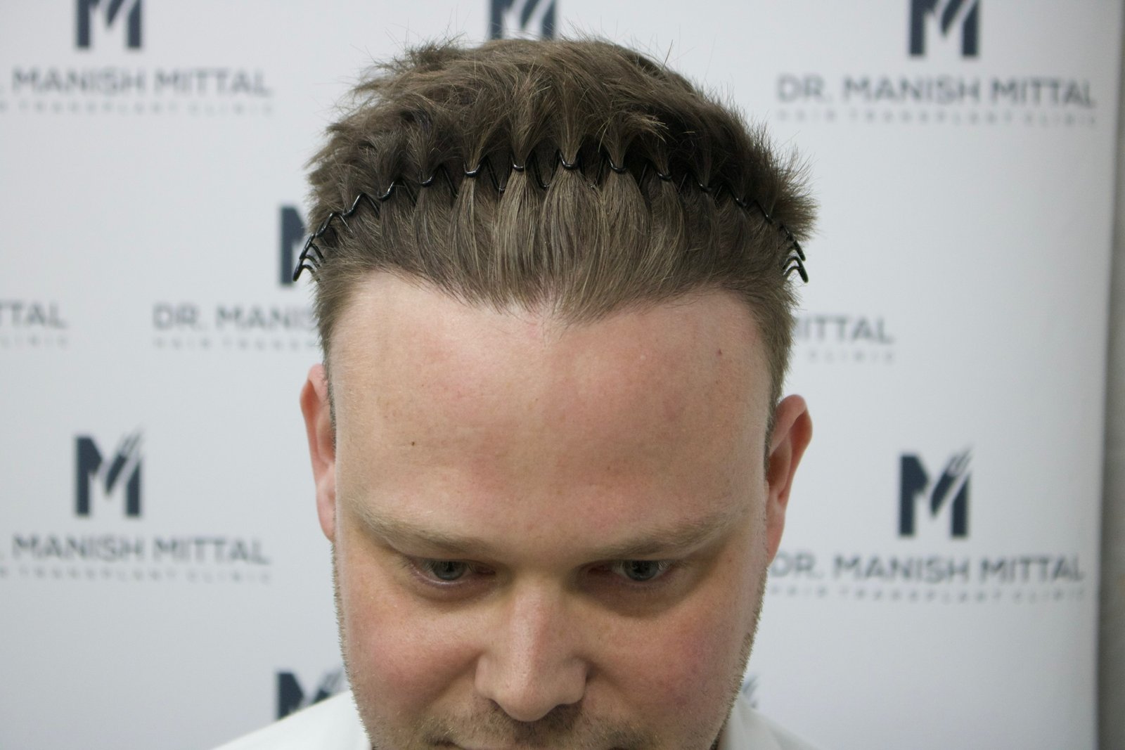 Sam Hinkes — after