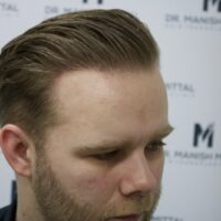 Ryan After Result