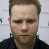 Ryan After Result
