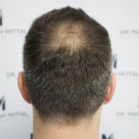 Jack C Before