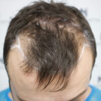 Dan C Before