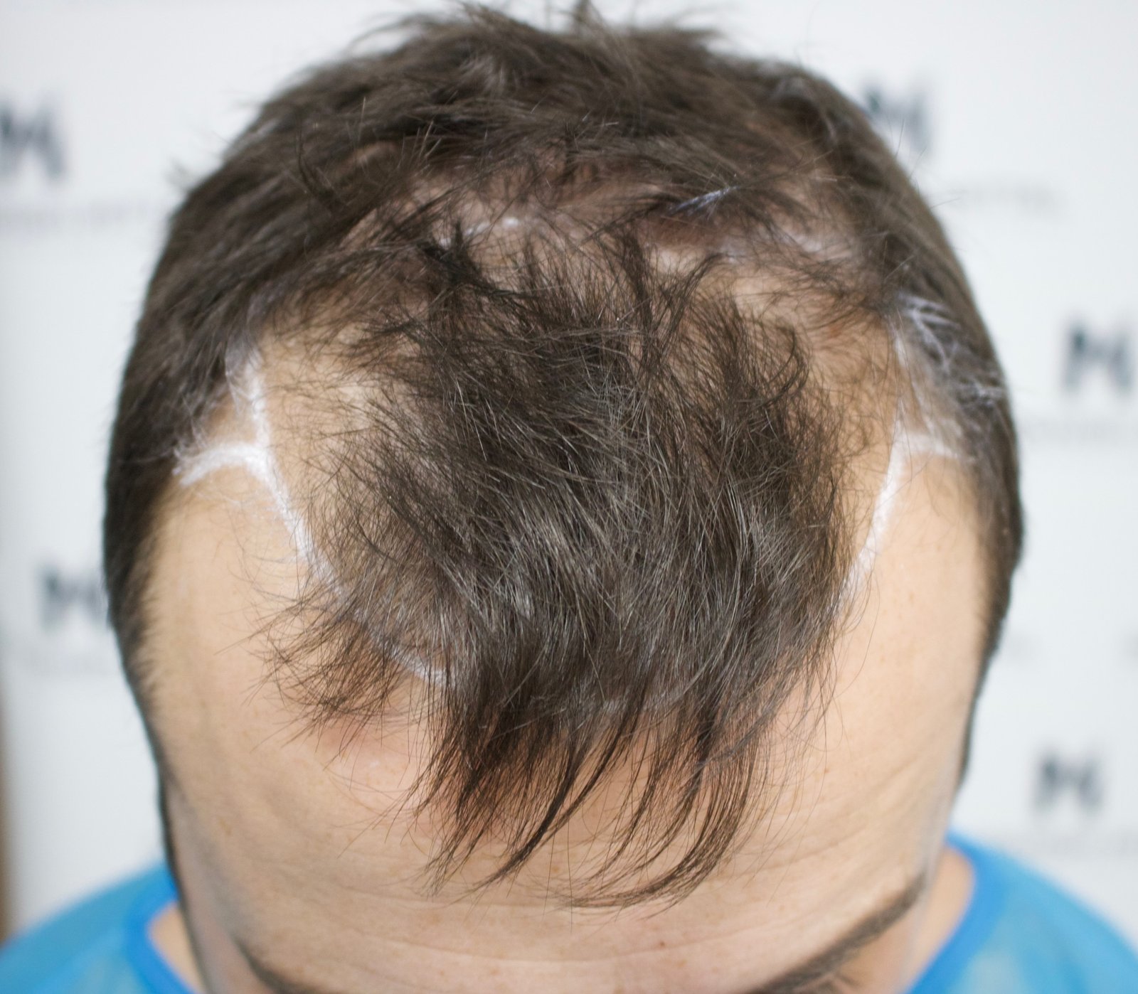 Dan C — before