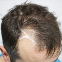 Dan C Before