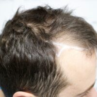 Dan C Before