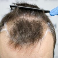 Dan C Before