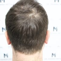 Dan C Before