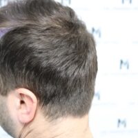 Dan C Before