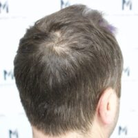 Dan C Before