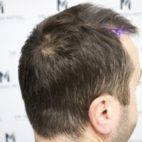 Dan C Before