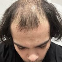 Zak Golding Before