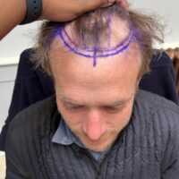 Steven J Before