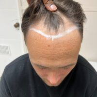 Matt Before