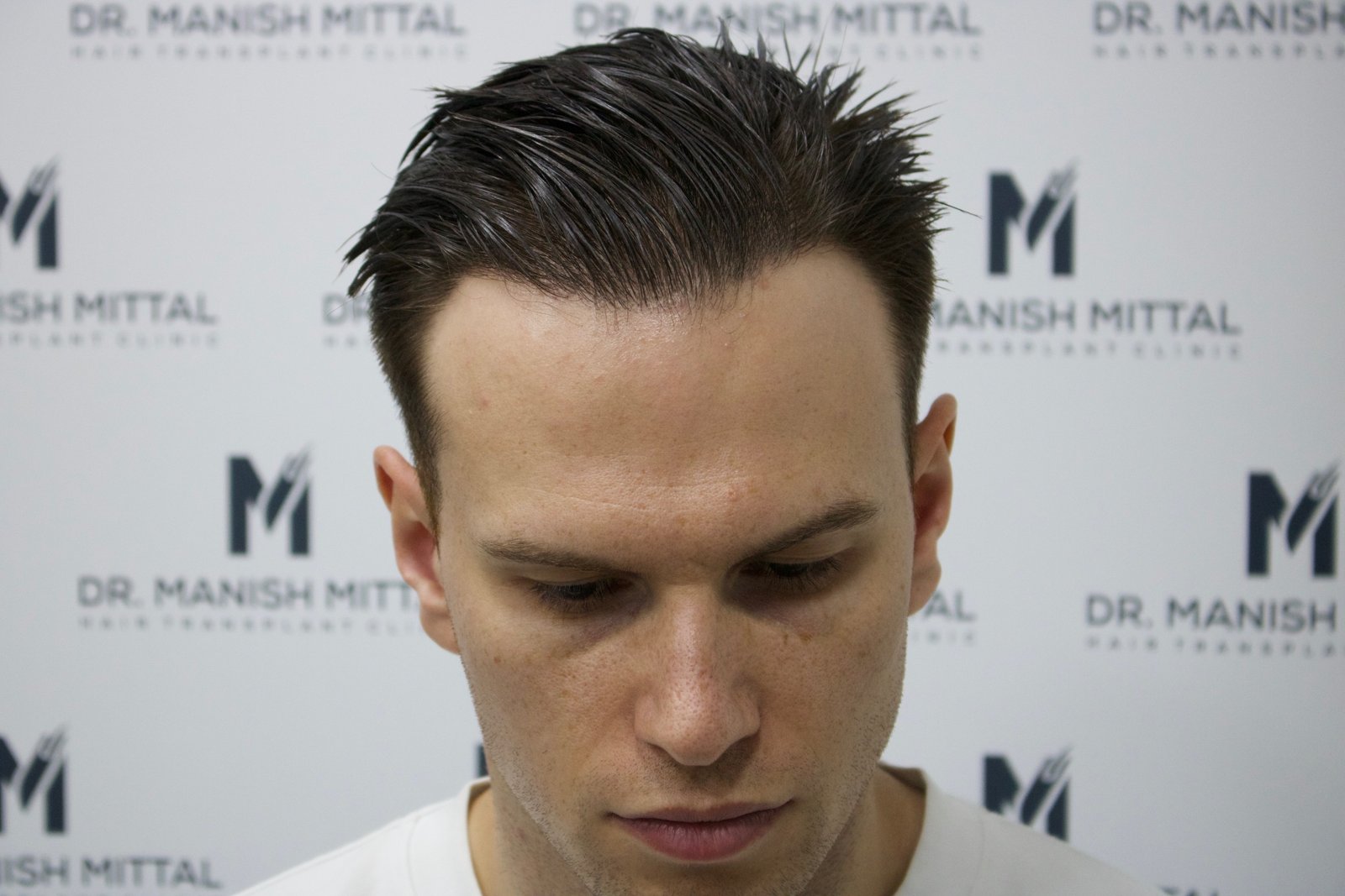 Ben Lewis — after