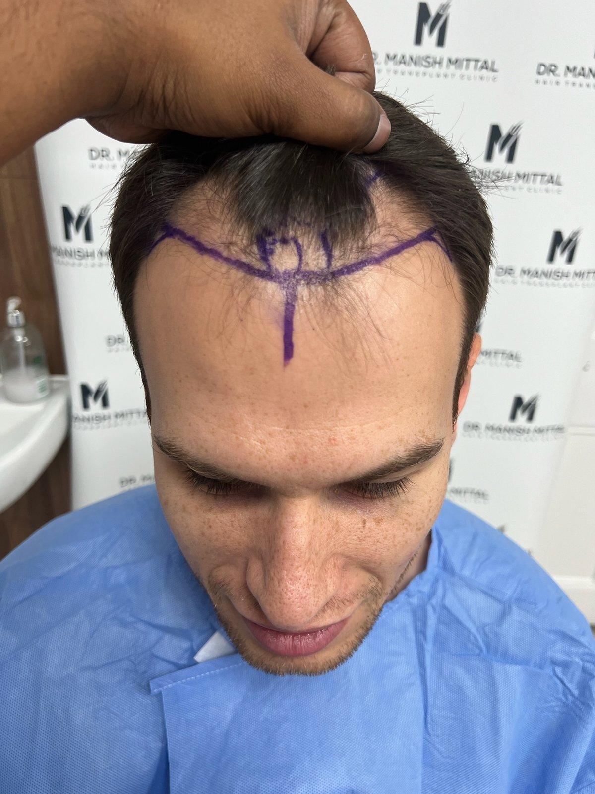 Ben Lewis — before