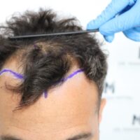 Roberto Before