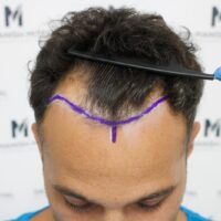 Roberto Before
