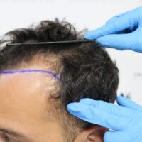 Roberto Before