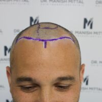 Roberto Before