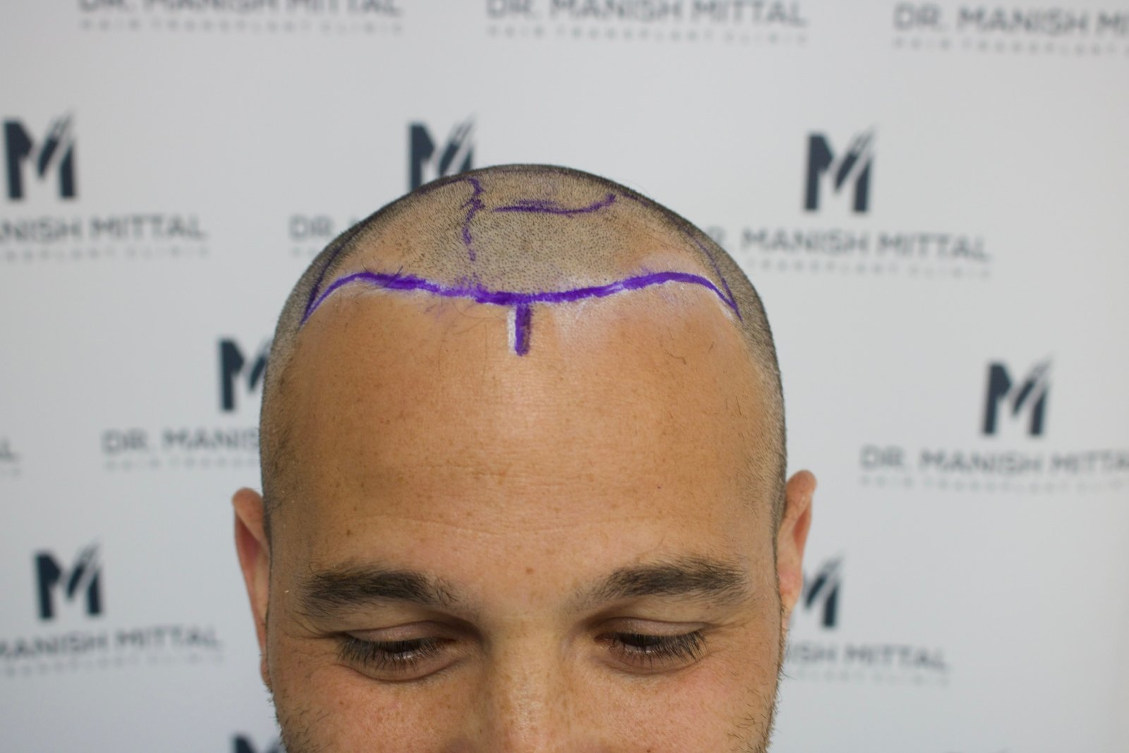 Roberto — before