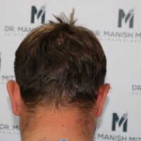 Tyler Moret Before