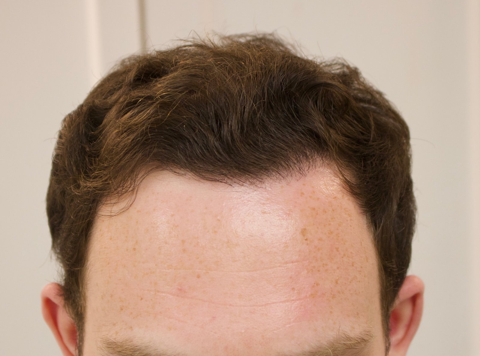 Phillip M — after