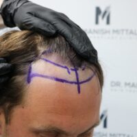 Tyler Moret Before