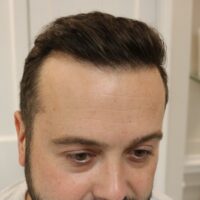 Dan C After Result