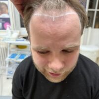 Ryan Before
