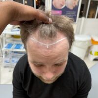 Ryan Before