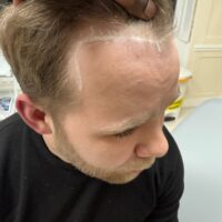 Ryan Before