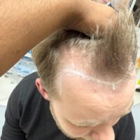 Ryan Before