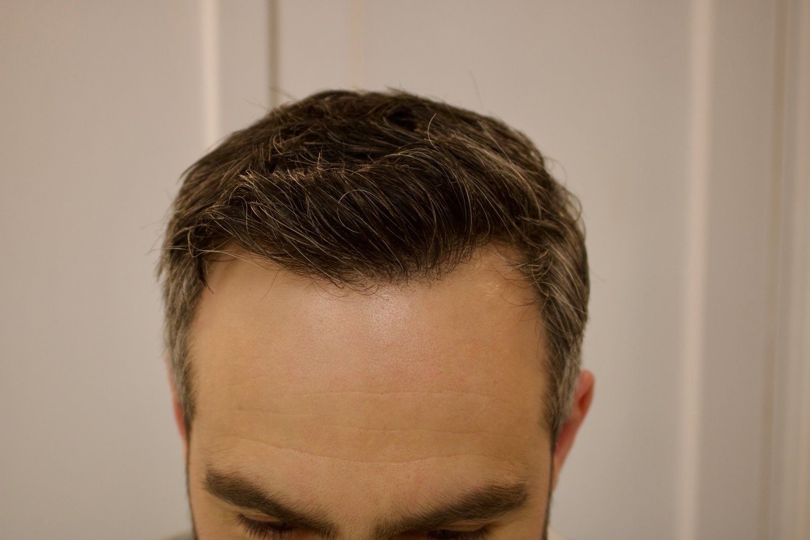 Jack C — after