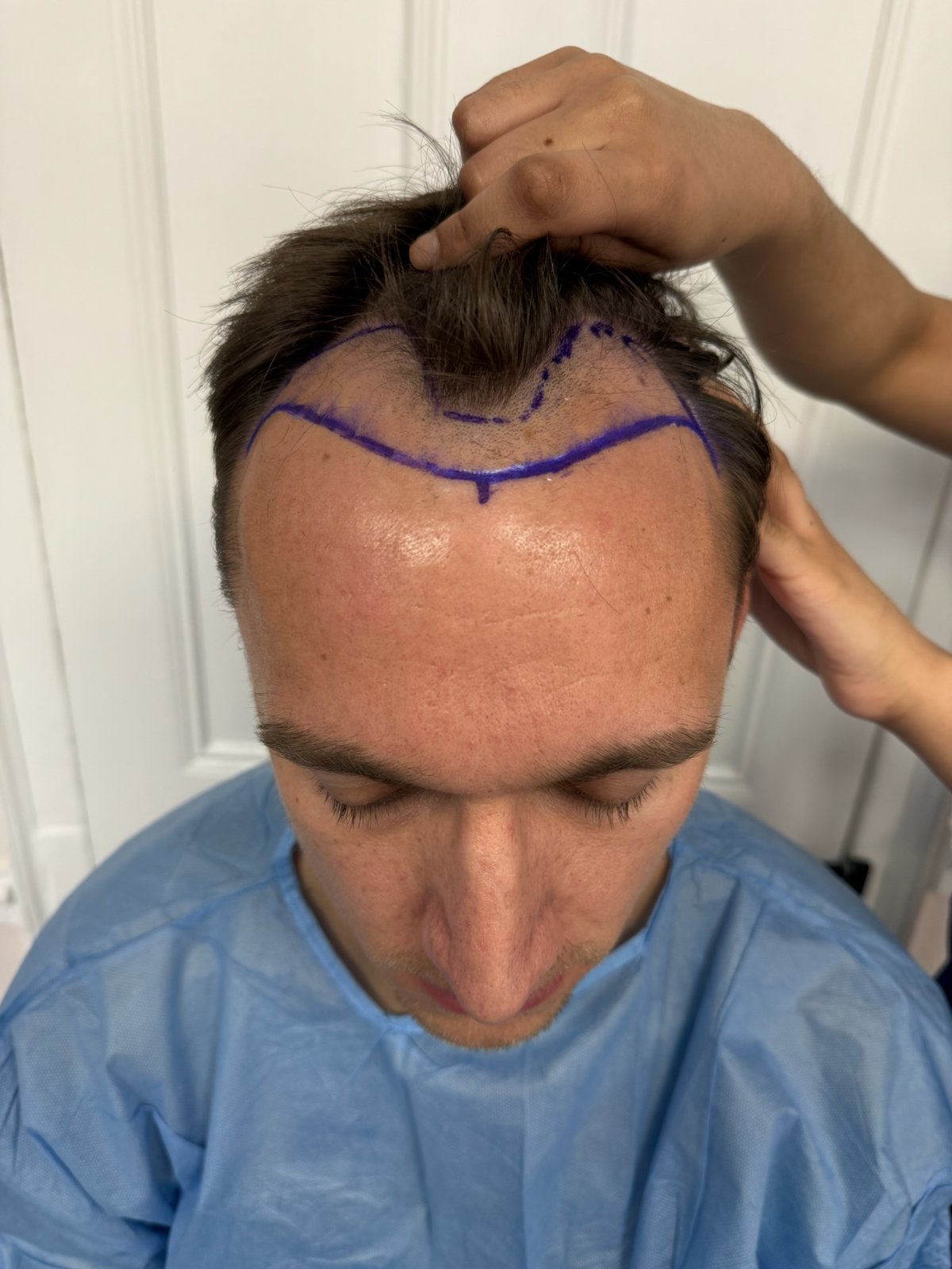 Jack Els — before