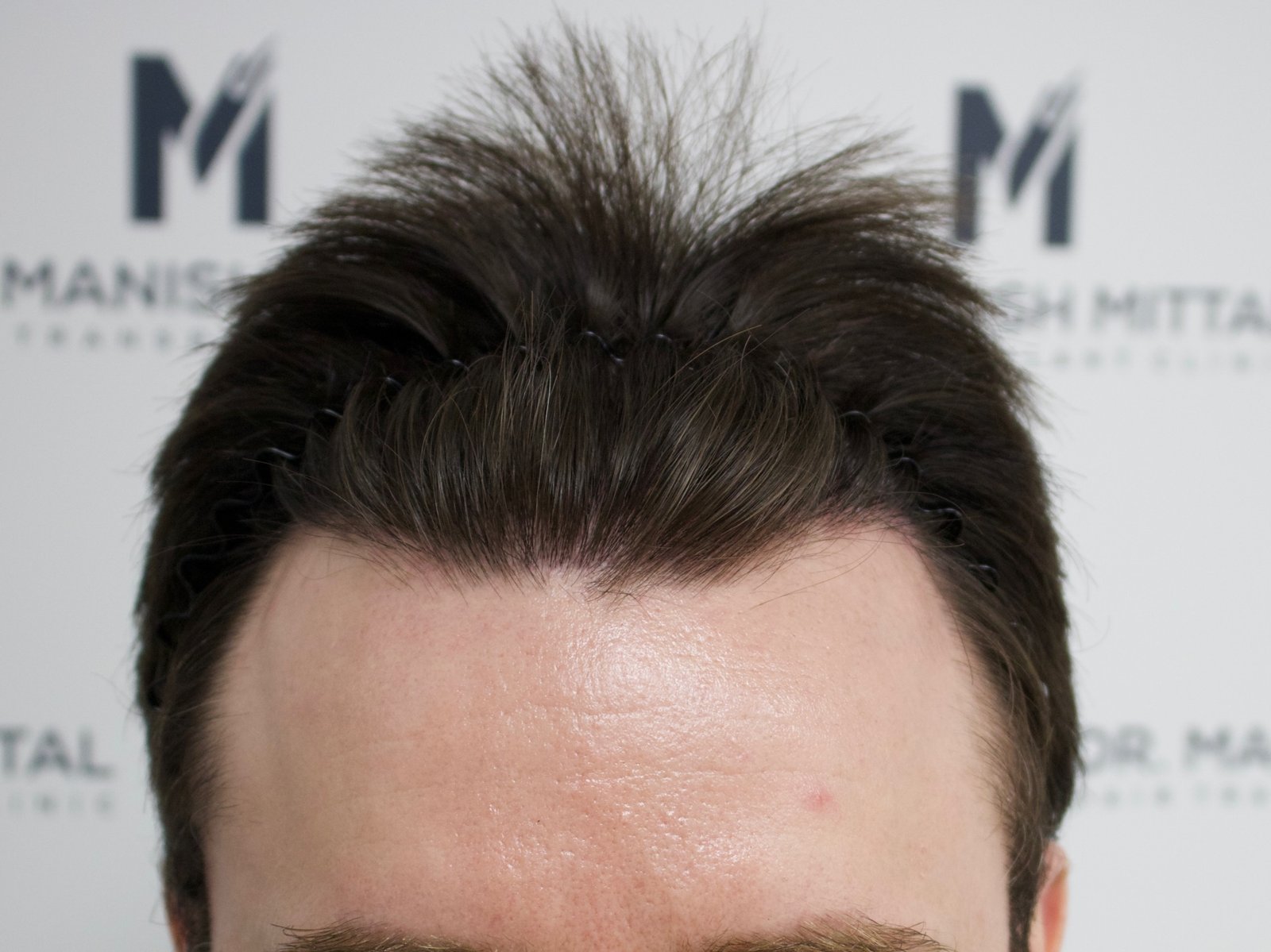 Kevin S — after