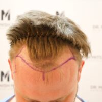 Sam Hinkes Before
