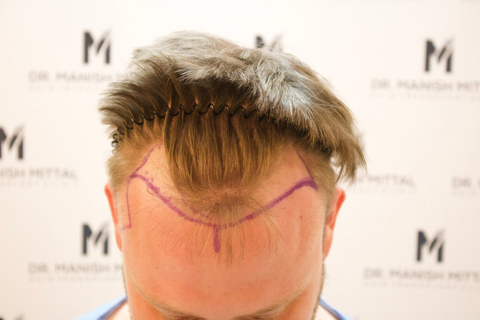 Sam Hinkes — before