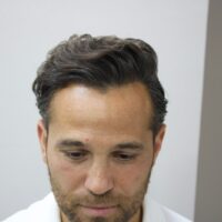 Roberto After Result
