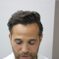 Roberto After Result