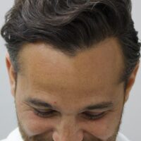 Roberto After Result