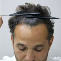 Roberto After Result