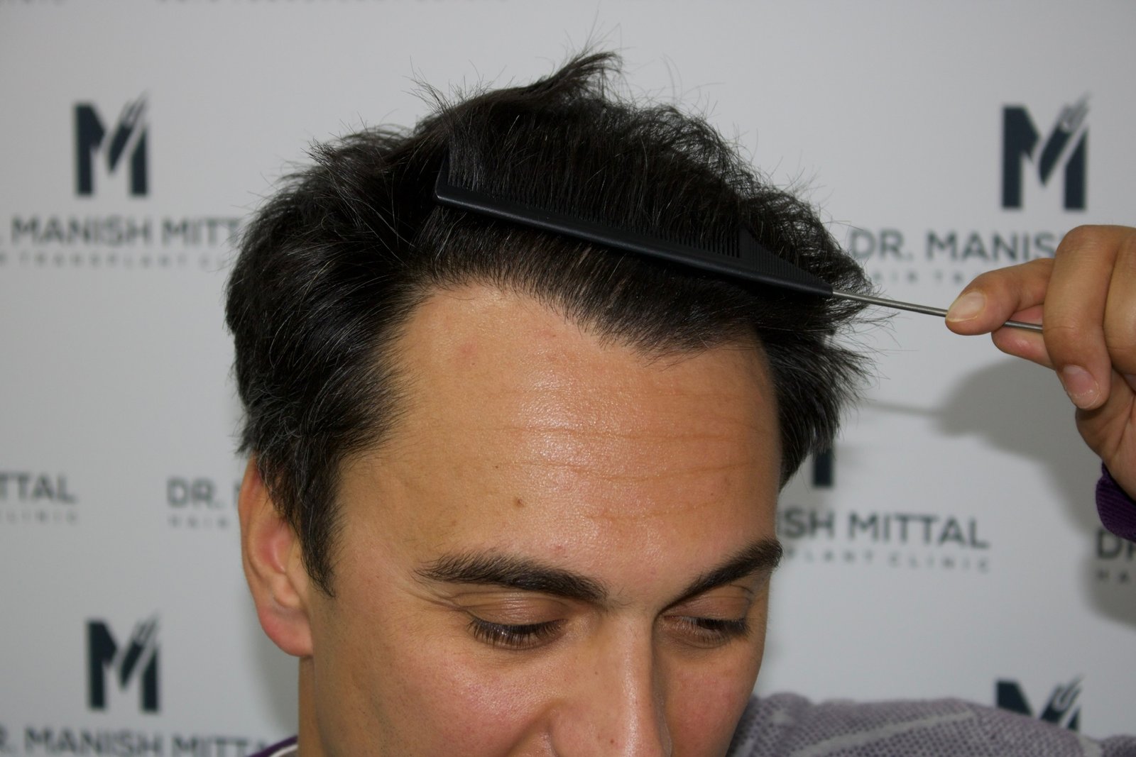 Chris V — after