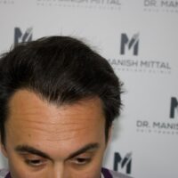 Chris V After Result